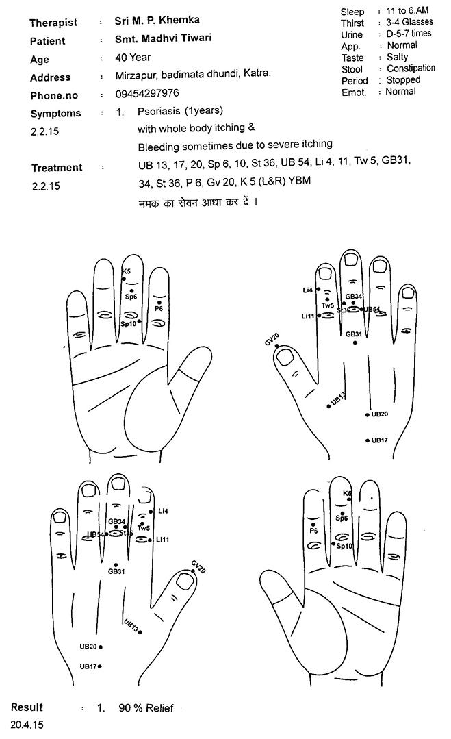 Psoriasis